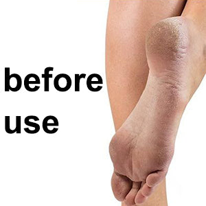Foot Files Foot Scrubber Pumice Stones Pedicure Rasp Gel Heel Sleeves - Natural Foot File Exfoliation to Remove Dead Skin