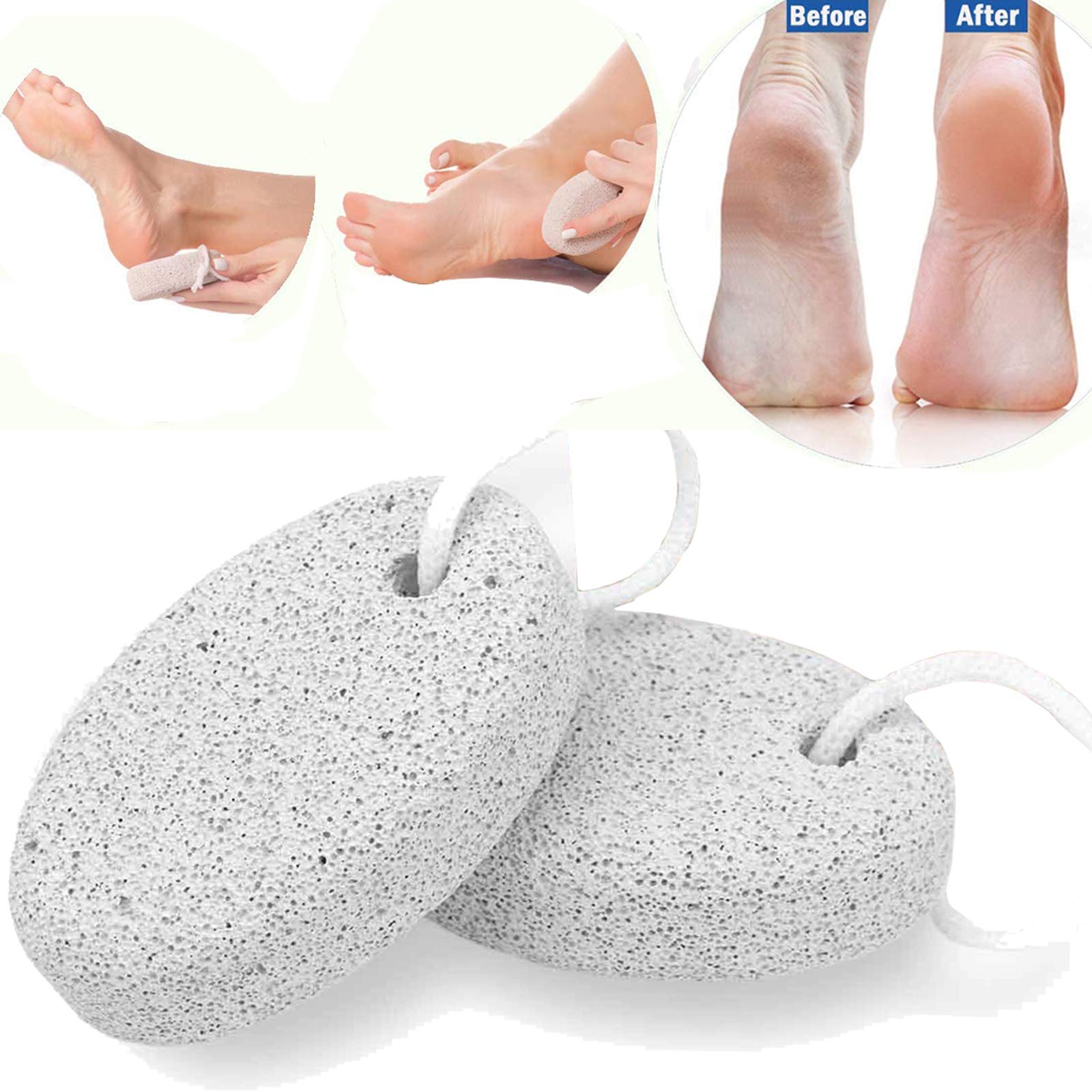 Pumice Stone for Feet 2 PCS Set_Foot Care Natural Pummice Stones for Dead Hard Skin_Foot Scrubber Calluses Removes_Gently Exfoliates Skin_Softer Smoother Heels_Beauty Foot File White Men Women by MUKA