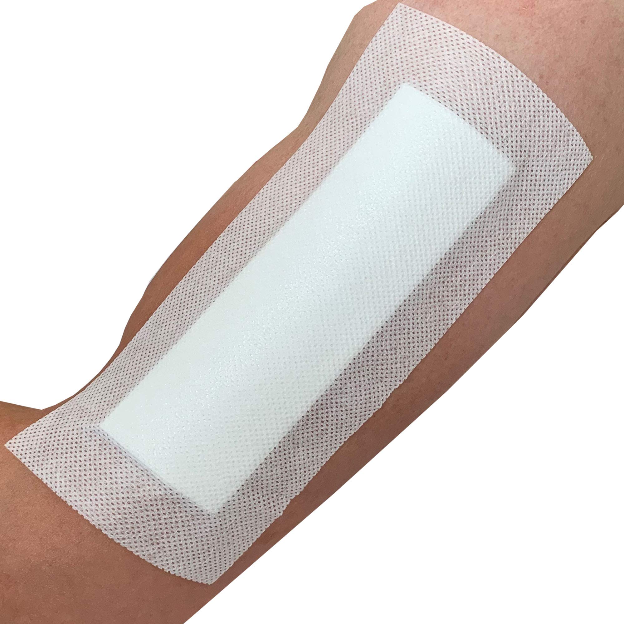 Pack of 25 Large Adhesive Sterile Wound Dressings - Suitable for cuts and grazes, Diabetic Leg ulcers, venous Leg ulcers, Pressure sores (10cm x 20cm)