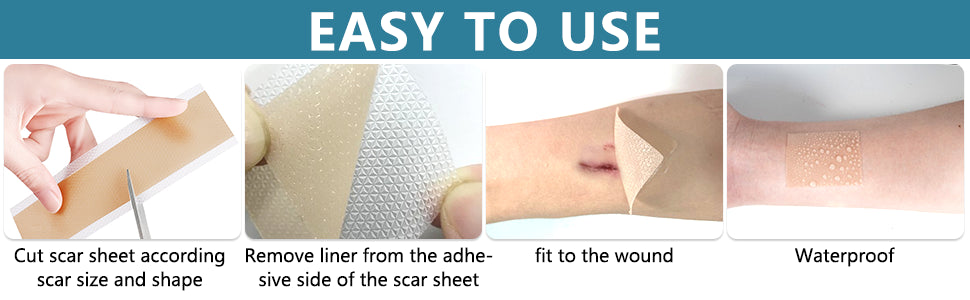 Valleylux Silicone Scar Tape Roll(1.5M),Medical-Grade Silicone Scar  sheets,Scar Sheets For Surgical Scars